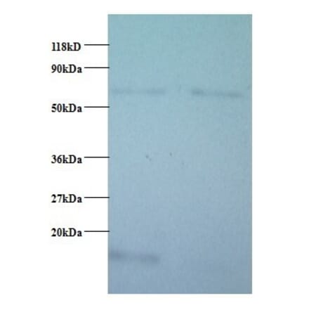 Cytochrome c oxidase subunit 5B, mitochondrial Polyclonal Antibody from Signalway Antibody (42093) - Antibodies.com