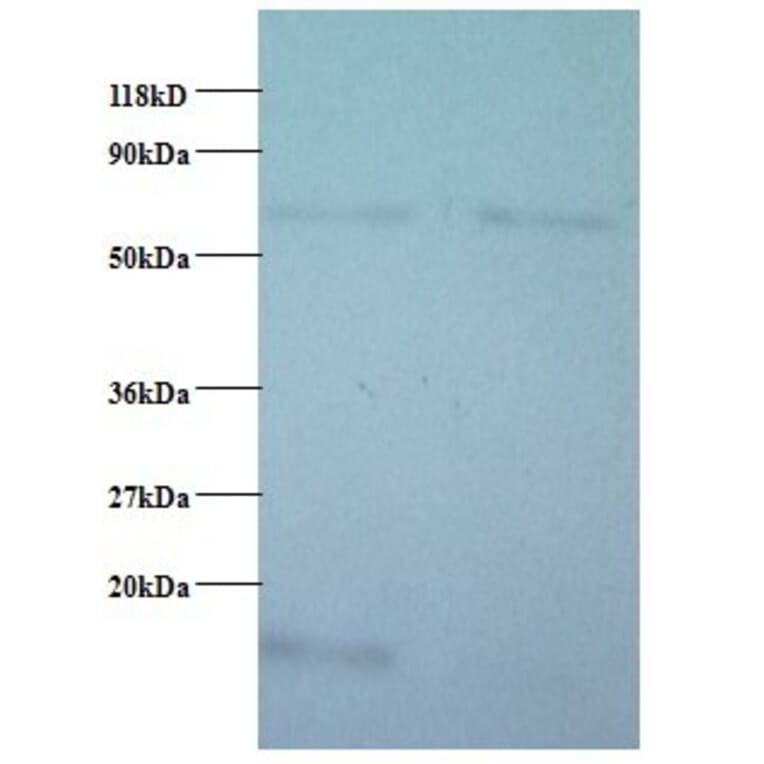Cytochrome c oxidase subunit 5B, mitochondrial Polyclonal Antibody from Signalway Antibody (42093) - Antibodies.com