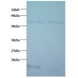Cytochrome c oxidase subunit 5B, mitochondrial Polyclonal Antibody from Signalway Antibody (42093) - Antibodies.com
