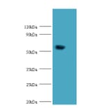Probable histidine--tRNA ligase, mitochondrial Polyclonal Antibody from Signalway Antibody (42199) - Antibodies.com