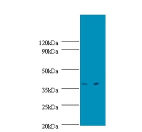 Transcription initiation protein SPT3 homolog Polyclonal Antibody from Signalway Antibody (42337) - Antibodies.com