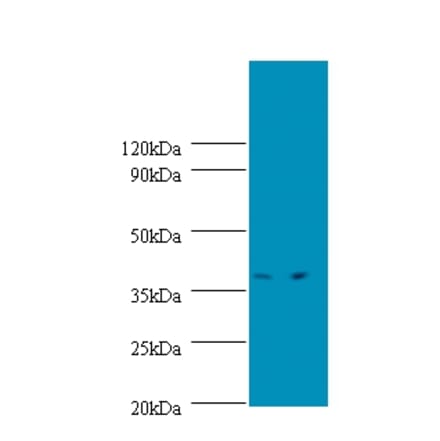 Transcription initiation protein SPT3 homolog Polyclonal Antibody from Signalway Antibody (42337) - Antibodies.com