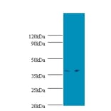 Transcription initiation protein SPT3 homolog Polyclonal Antibody from Signalway Antibody (42337) - Antibodies.com