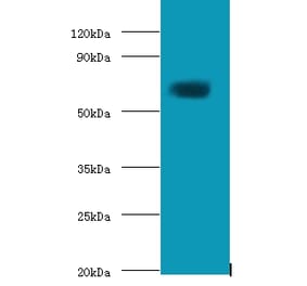 Protein-glutamine gamma-glutamyltransferase 2 Polyclonal Antibody from Signalway Antibody (42550) - Antibodies.com