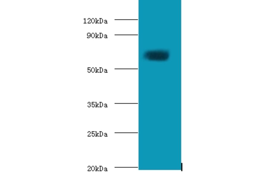Protein-glutamine gamma-glutamyltransferase 2 Polyclonal Antibody from Signalway Antibody (42550) - Antibodies.com