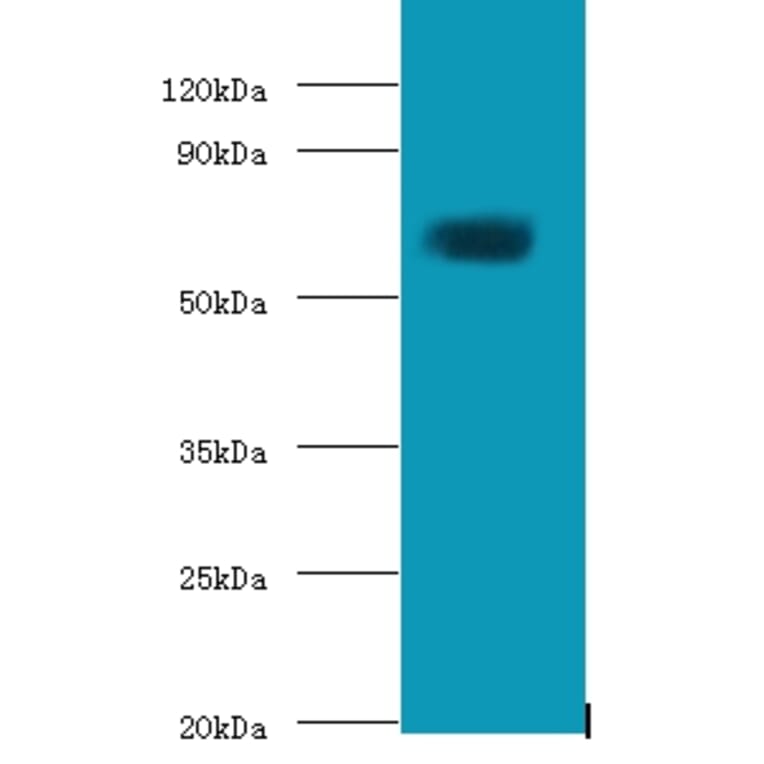 Protein-glutamine gamma-glutamyltransferase 2 Polyclonal Antibody from Signalway Antibody (42550) - Antibodies.com