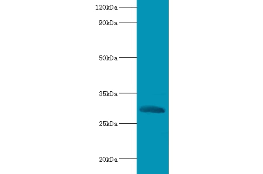 Chymotrypsin-like elastase family member 2A Polyclonal Antibody from Signalway Antibody (42119) - Antibodies.com