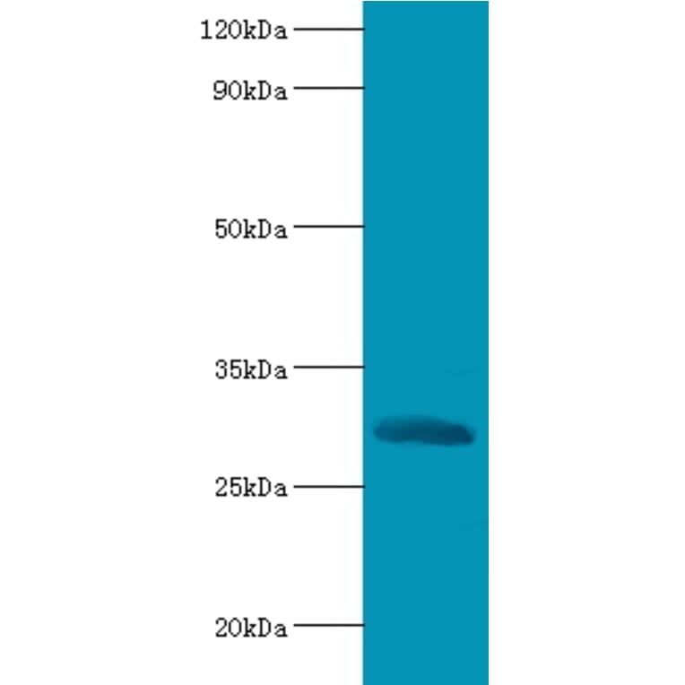 Chymotrypsin-like elastase family member 2A Polyclonal Antibody from Signalway Antibody (42119) - Antibodies.com