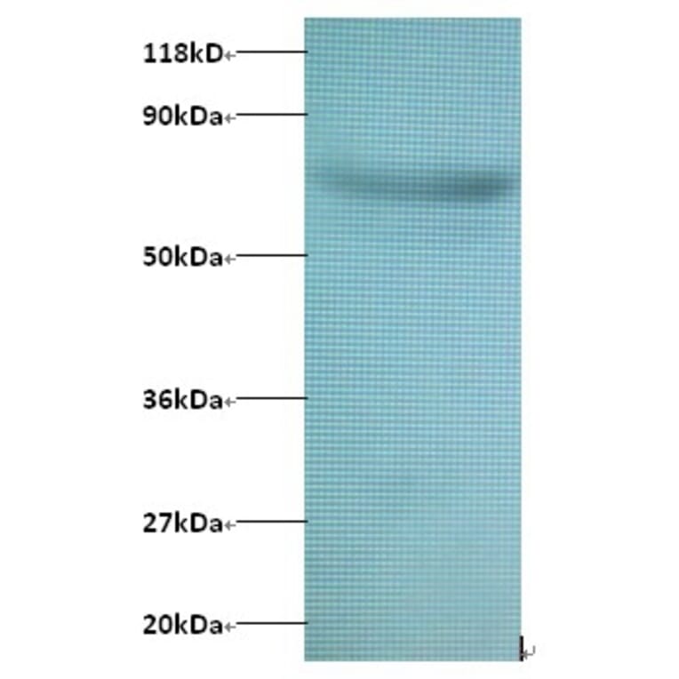 Actin-related protein 2/3 complex subunit 3 Polyclonal Antibody from Signalway Antibody (42389) - Antibodies.com