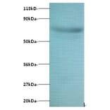 Actin-related protein 2/3 complex subunit 3 Polyclonal Antibody from Signalway Antibody (42389) - Antibodies.com