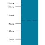 POU domain, class 5, transcription factor 1 Polyclonal Antibody from Signalway Antibody (42543) - Antibodies.com