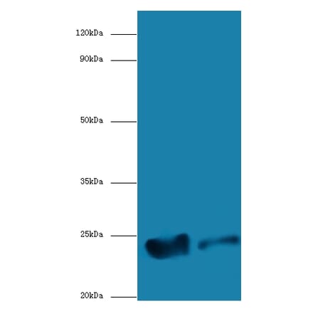 Peptidyl-tRNA hydrolase ICT1, mitochondrial Polyclonal Antibody from Signalway Antibody (42645) - Antibodies.com