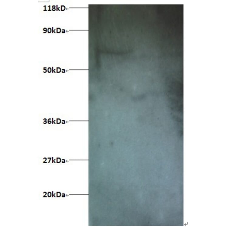 Interferon-induced transmembrane protein 1 Polyclonal Antibody from Signalway Antibody (42229) - Antibodies.com