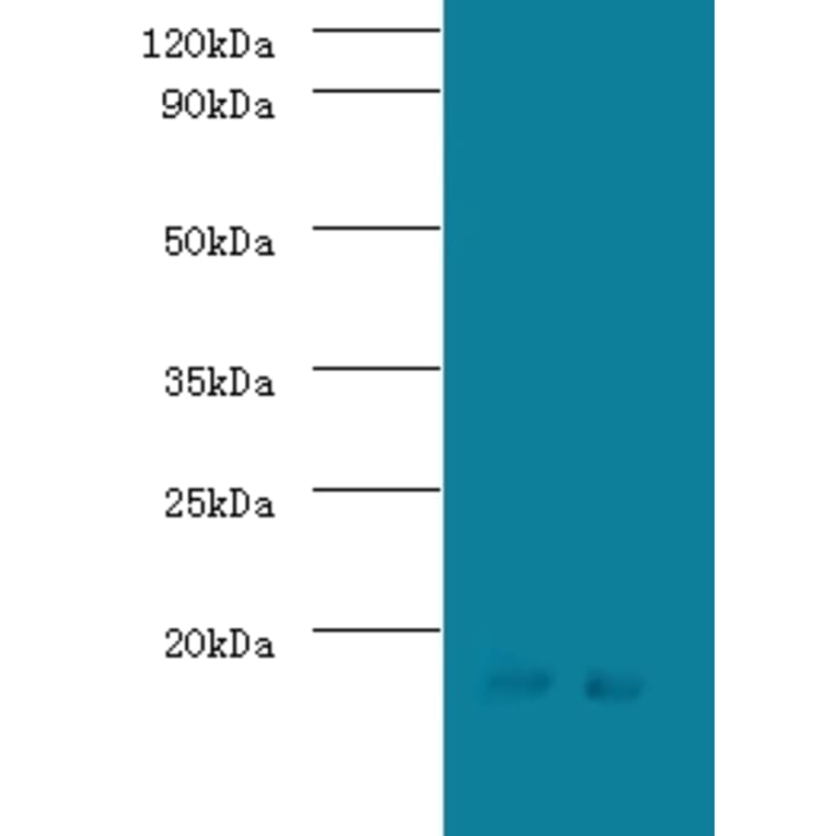 Signal recognition particle 19 kDa protein Polyclonal Antibody from Signalway Antibody (42332) - Antibodies.com