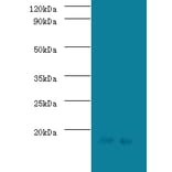 Signal recognition particle 19 kDa protein Polyclonal Antibody from Signalway Antibody (42332) - Antibodies.com