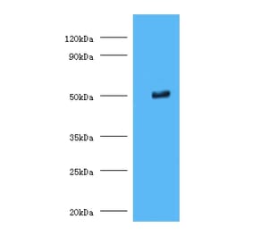 Trimethyllysine dioxygenase, mitochondrial Polyclonal Antibody from Signalway Antibody (42348) - Antibodies.com