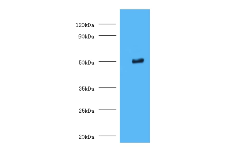 Trimethyllysine dioxygenase, mitochondrial Polyclonal Antibody from Signalway Antibody (42348) - Antibodies.com