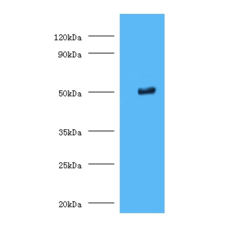 Trimethyllysine dioxygenase, mitochondrial Polyclonal Antibody from Signalway Antibody (42348) - Antibodies.com