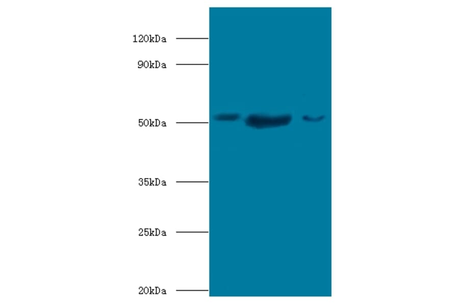 BAG family molecular chaperone regulator 5 Polyclonal Antibody from Signalway Antibody (42692) - Antibodies.com