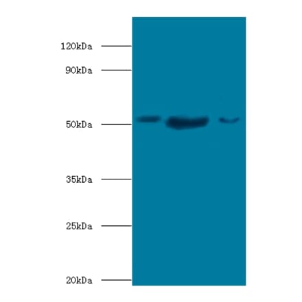 BAG family molecular chaperone regulator 5 Polyclonal Antibody from Signalway Antibody (42692) - Antibodies.com