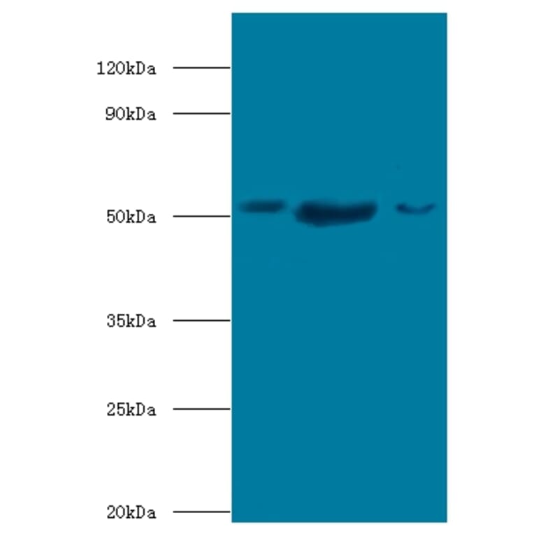 BAG family molecular chaperone regulator 5 Polyclonal Antibody from Signalway Antibody (42692) - Antibodies.com