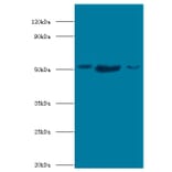 BAG family molecular chaperone regulator 5 Polyclonal Antibody from Signalway Antibody (42692) - Antibodies.com