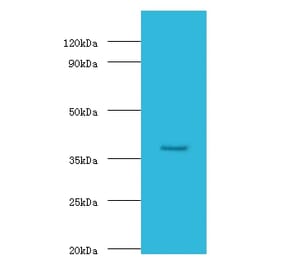 Galactose-1-phosphate uridylyltransferase Polyclonal Antibody from Signalway Antibody (42174) - Antibodies.com