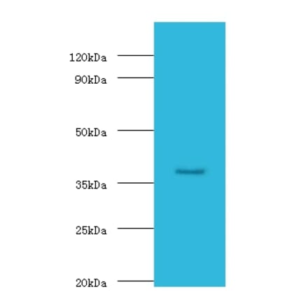 Galactose-1-phosphate uridylyltransferase Polyclonal Antibody from Signalway Antibody (42174) - Antibodies.com