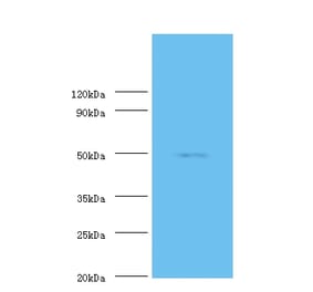 Mothers against decapentaplegic homolog 3 Polyclonal Antibody from Signalway Antibody (42327) - Antibodies.com