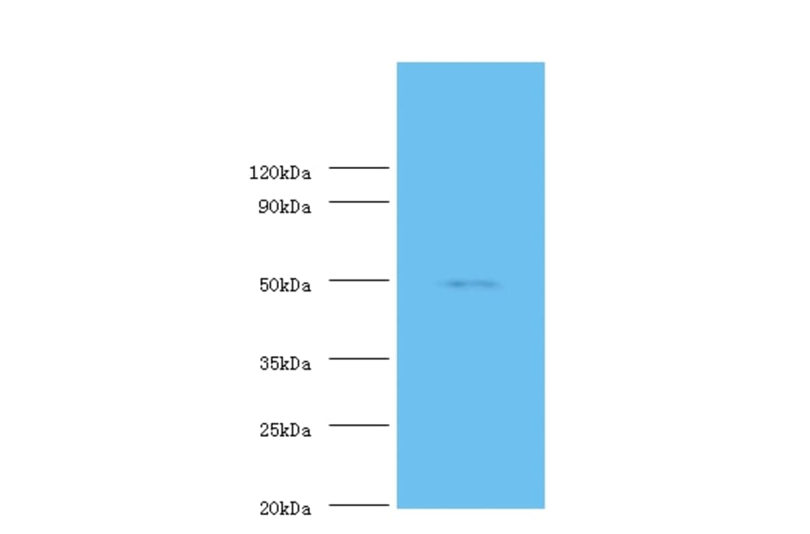 Mothers against decapentaplegic homolog 3 Polyclonal Antibody from Signalway Antibody (42327) - Antibodies.com