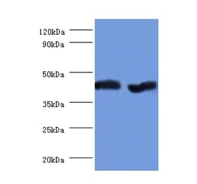 Aspartate aminotransferase, mitochondrial Polyclonal Antibody from Signalway Antibody (42384) - Antibodies.com