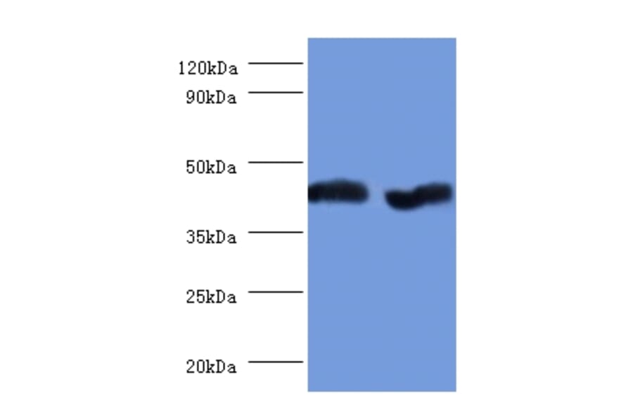 Aspartate aminotransferase, mitochondrial Polyclonal Antibody from Signalway Antibody (42384) - Antibodies.com