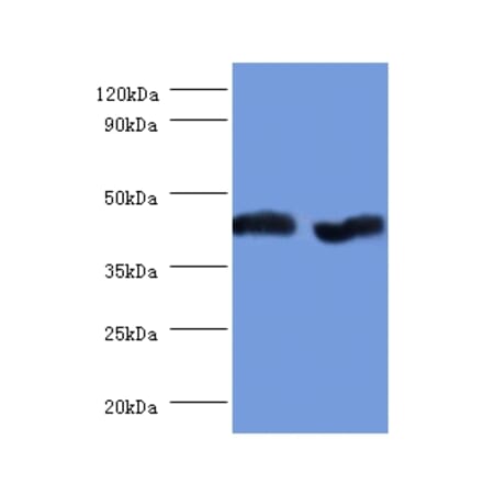 Aspartate aminotransferase, mitochondrial Polyclonal Antibody from Signalway Antibody (42384) - Antibodies.com