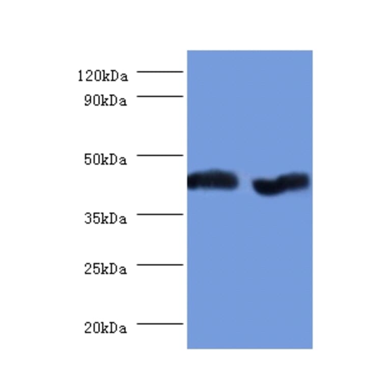 Aspartate aminotransferase, mitochondrial Polyclonal Antibody from Signalway Antibody (42384) - Antibodies.com