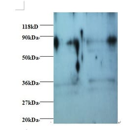 Heterogeneous nuclear ribonucleoprotein H Polyclonal Antibody from Signalway Antibody (42411) - Antibodies.com