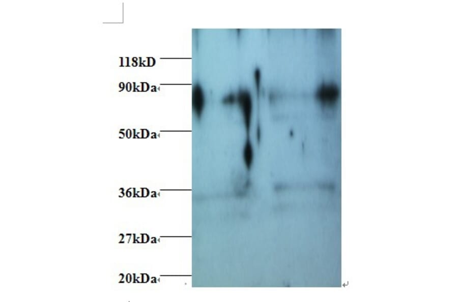 Heterogeneous nuclear ribonucleoprotein H Polyclonal Antibody from Signalway Antibody (42411) - Antibodies.com