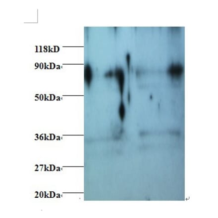 Heterogeneous nuclear ribonucleoprotein H Polyclonal Antibody from Signalway Antibody (42411) - Antibodies.com