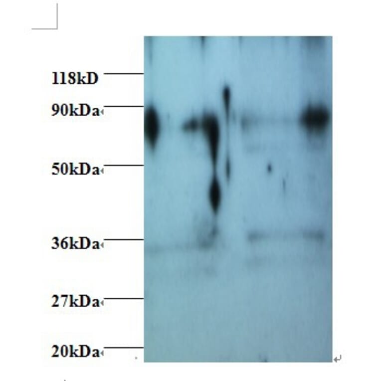 Heterogeneous nuclear ribonucleoprotein H Polyclonal Antibody from Signalway Antibody (42411) - Antibodies.com