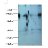 Heterogeneous nuclear ribonucleoprotein H Polyclonal Antibody from Signalway Antibody (42411) - Antibodies.com