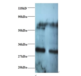 Rho guanine nucleotide exchange factor 18 Polyclonal Antibody from Signalway Antibody (42430) - Antibodies.com