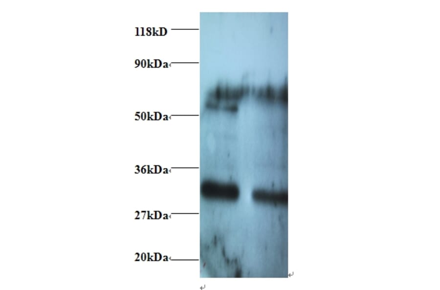Rho guanine nucleotide exchange factor 18 Polyclonal Antibody from Signalway Antibody (42430) - Antibodies.com