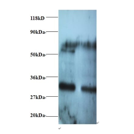 Rho guanine nucleotide exchange factor 18 Polyclonal Antibody from Signalway Antibody (42430) - Antibodies.com