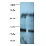 Rho guanine nucleotide exchange factor 18 Polyclonal Antibody from Signalway Antibody (42430) - Antibodies.com