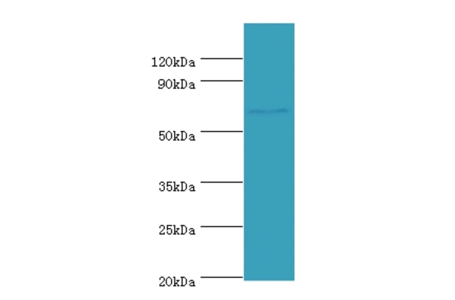 Leucine-rich repeat-containing protein 40 Polyclonal Antibody from Signalway Antibody (42688) - Antibodies.com