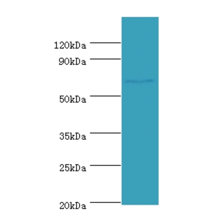 Leucine-rich repeat-containing protein 40 Polyclonal Antibody from Signalway Antibody (42688) - Antibodies.com