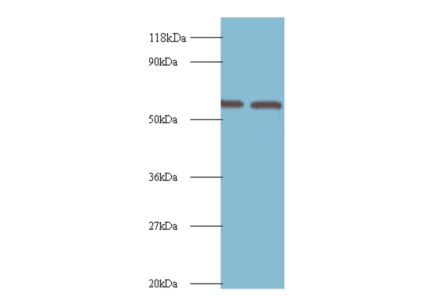 Inosine-5'-monophosphate dehydrogenase 2 Polyclonal Antibody from Signalway Antibody (42226) - Antibodies.com