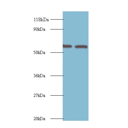Inosine-5'-monophosphate dehydrogenase 2 Polyclonal Antibody from Signalway Antibody (42226) - Antibodies.com