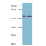 Inosine-5'-monophosphate dehydrogenase 2 Polyclonal Antibody from Signalway Antibody (42226) - Antibodies.com