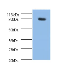 Rho guanine nucleotide exchange factor 7 Polyclonal Antibody from Signalway Antibody (42257) - Antibodies.com