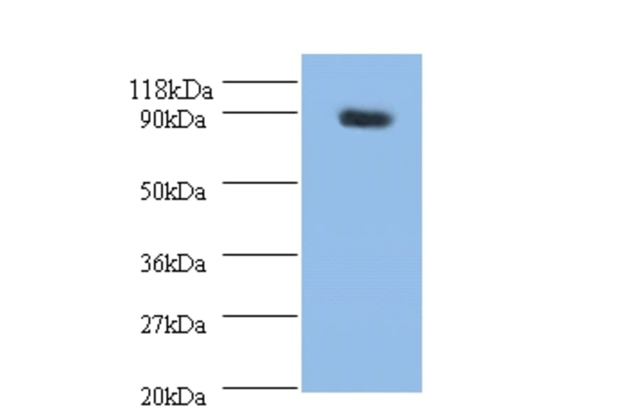 Rho guanine nucleotide exchange factor 7 Polyclonal Antibody from Signalway Antibody (42257) - Antibodies.com